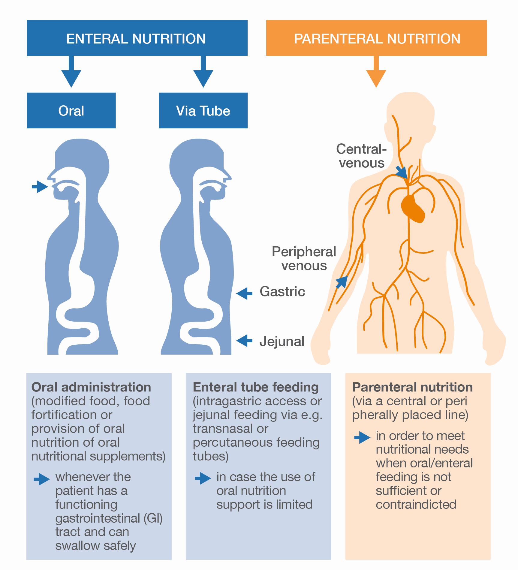 Methods of nutrition support (based on NICE (2006; 2017) and reproduced by kind permission of Fresenius Kabi)